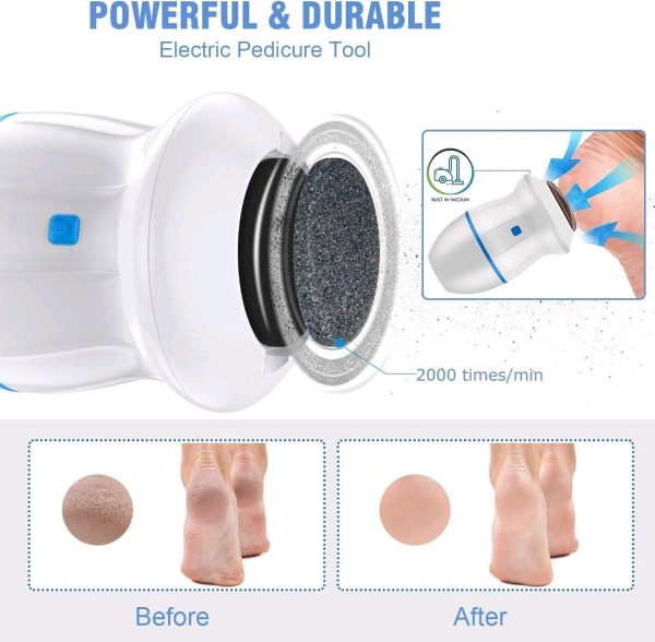 Professional Electric Foot Callus Remover - Portable Foot Grinder & Vacuum Pedicure Tool for Cracked Heels and Dead Skin